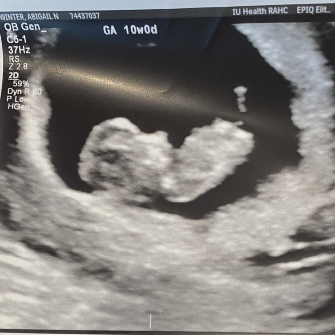 Photo shared by Abigail for their Babylist baby registry.