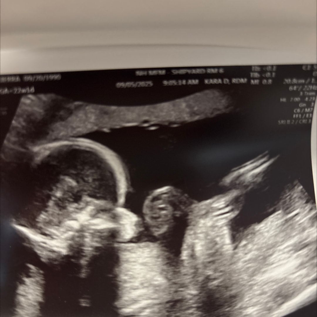 Photo shared by Sierra for their Babylist baby registry.