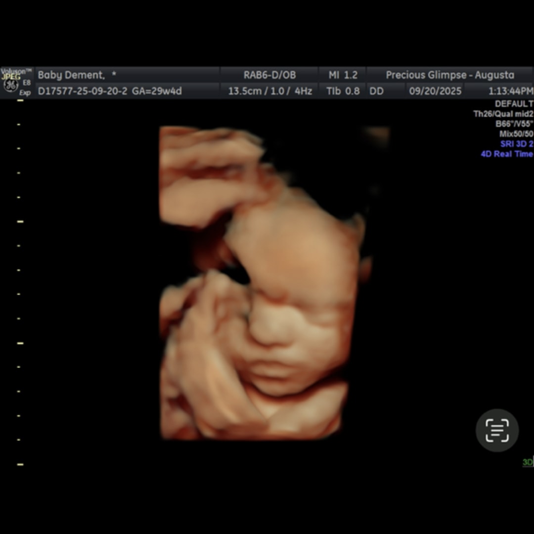 Photo shared by Emily for their Babylist baby registry.