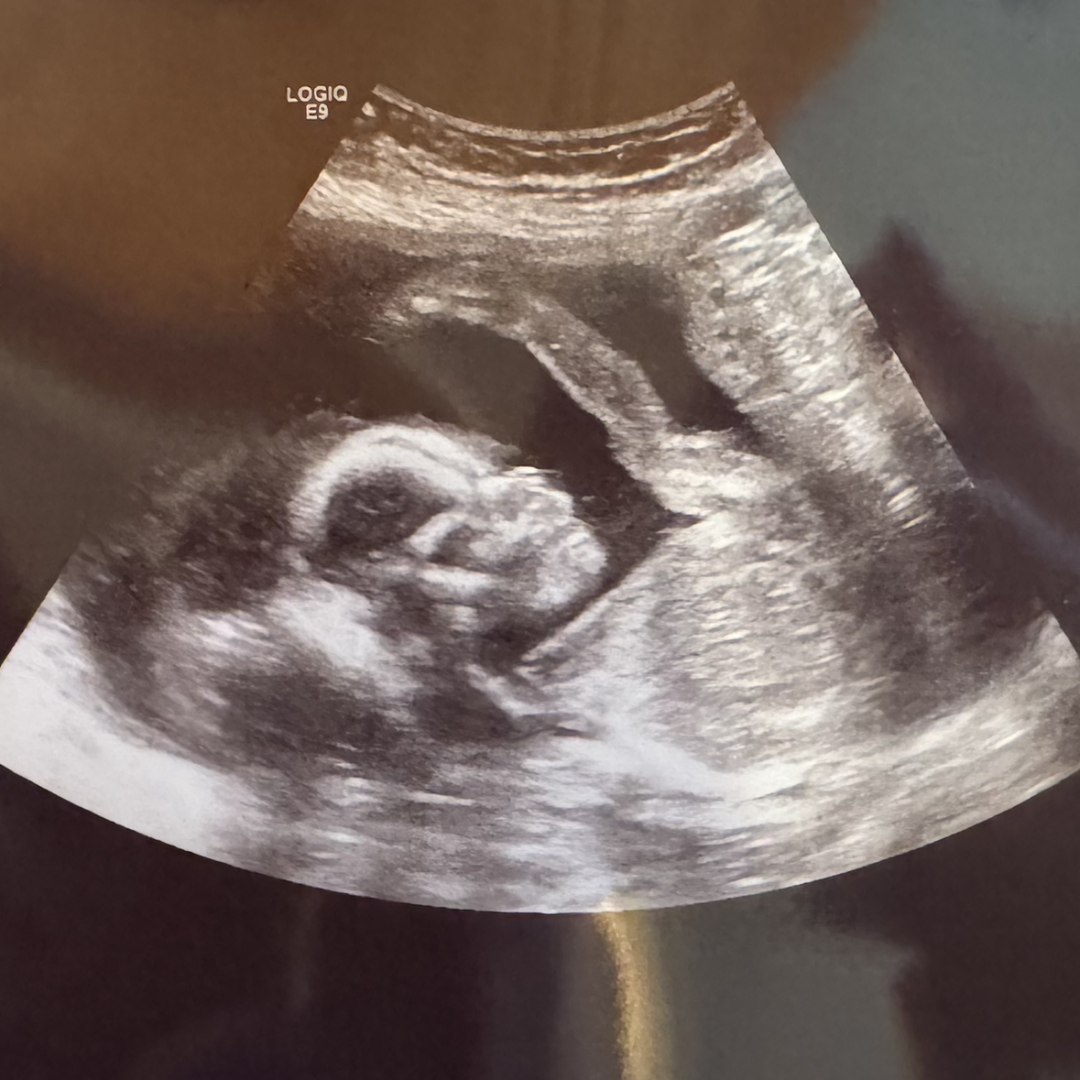 Photo shared by Natalie for their Babylist baby registry.