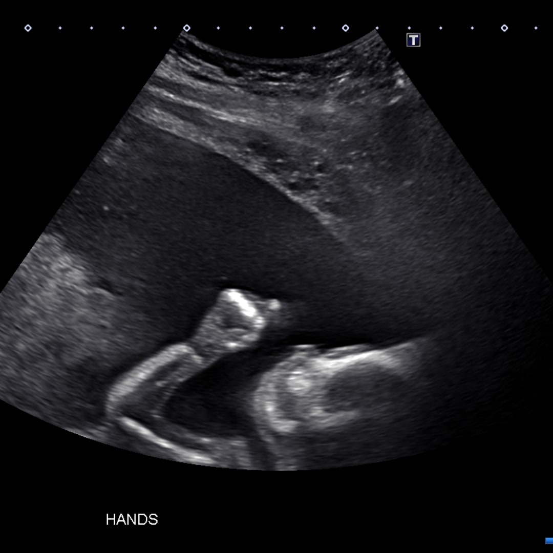 Photo shared by Shannan for their Babylist baby registry.