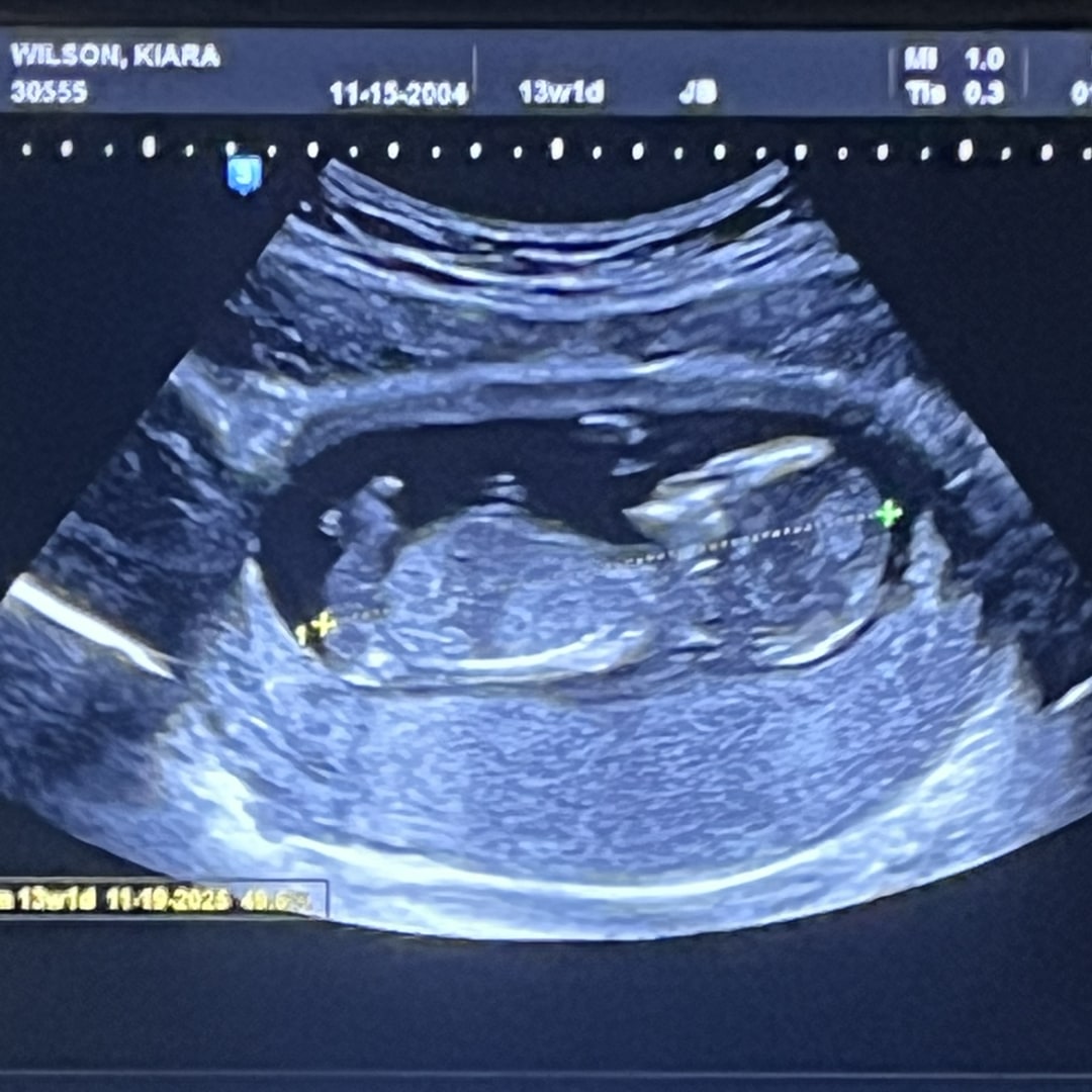 Photo shared by Kiara for their Babylist baby registry.