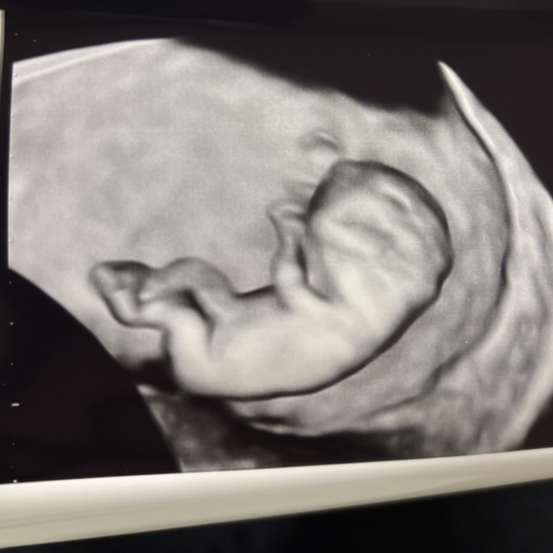 Photo shared by Elizabeth for their Babylist baby registry.