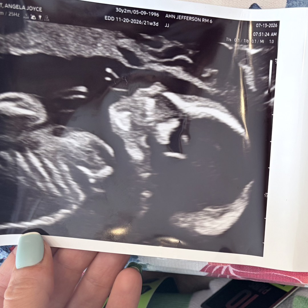 Photo shared by Angela for their Babylist baby registry.