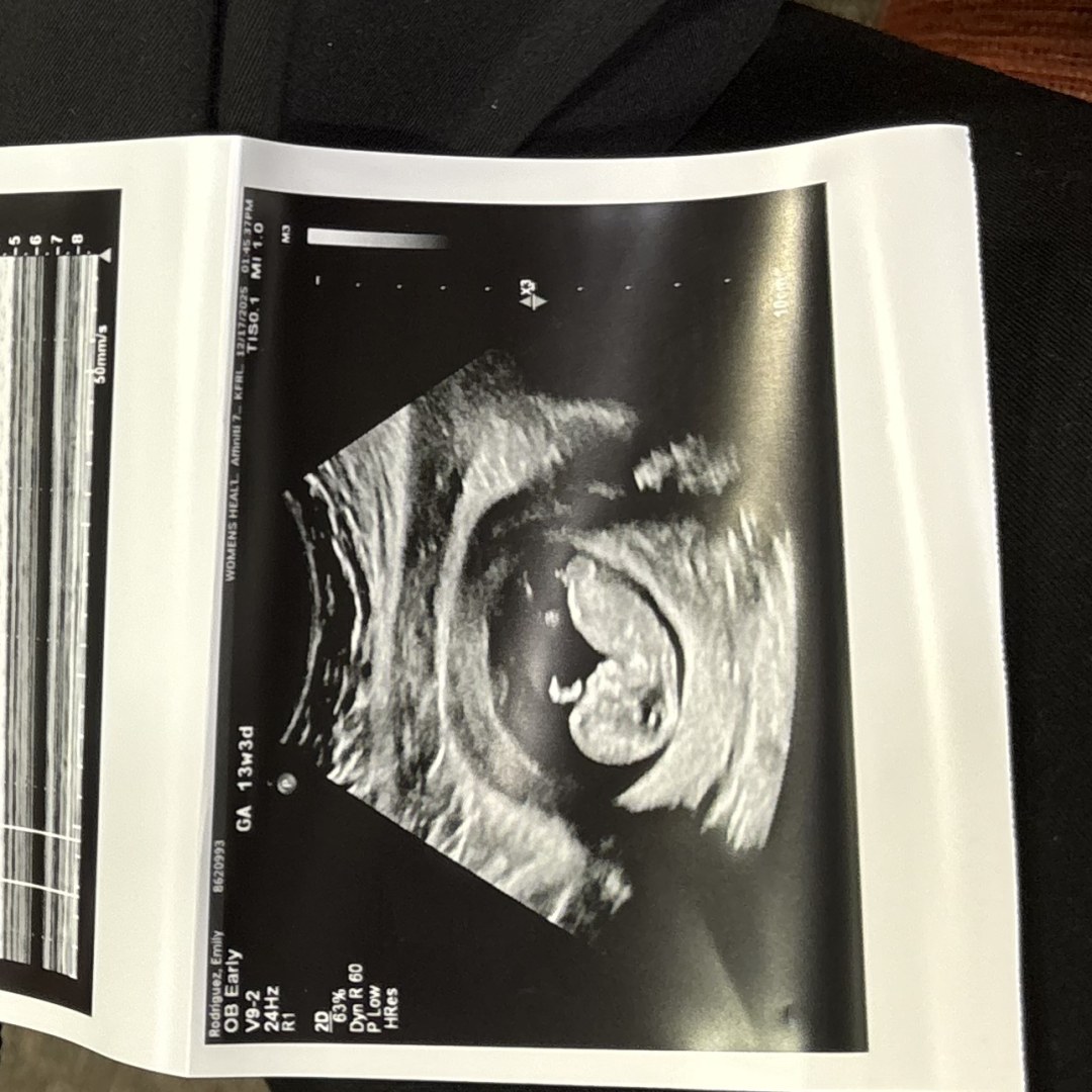 Photo shared by Emily for their Babylist baby registry.