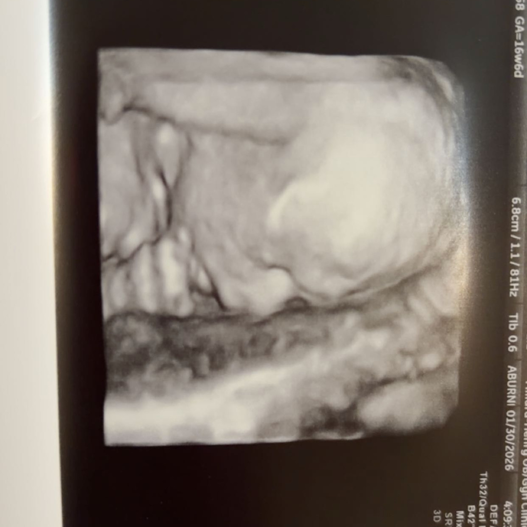 Photo shared by Mckenzie for their Babylist baby registry.