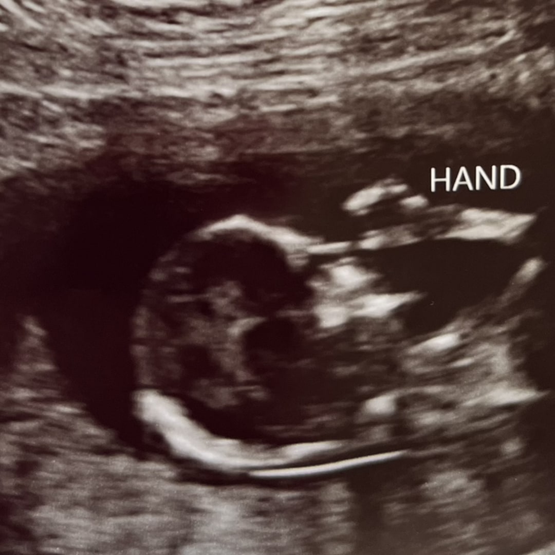 Photo shared by Anna for their Babylist baby registry.