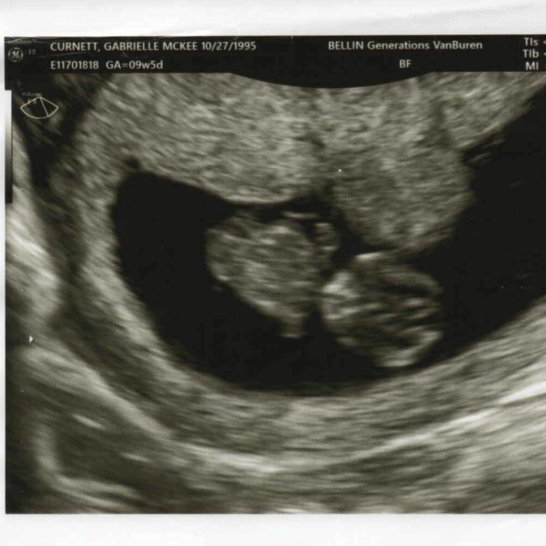 Photo shared by Gabrielle for their Babylist baby registry.