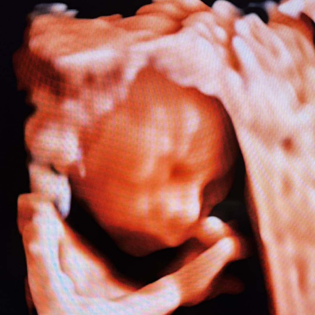 Photo shared by Carolina for their Babylist baby registry.