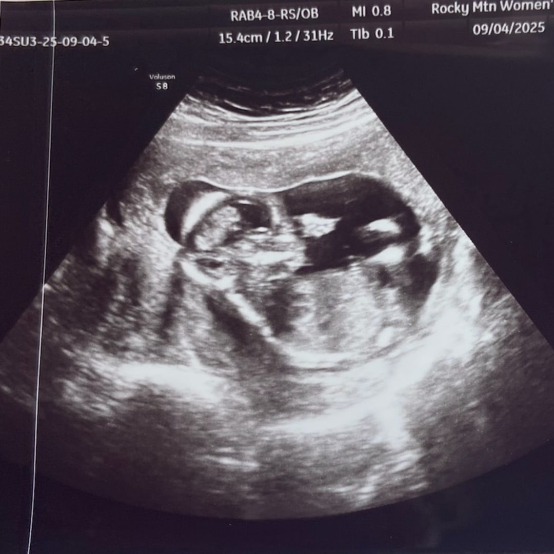 Photo shared by Adyson for their Babylist baby registry.