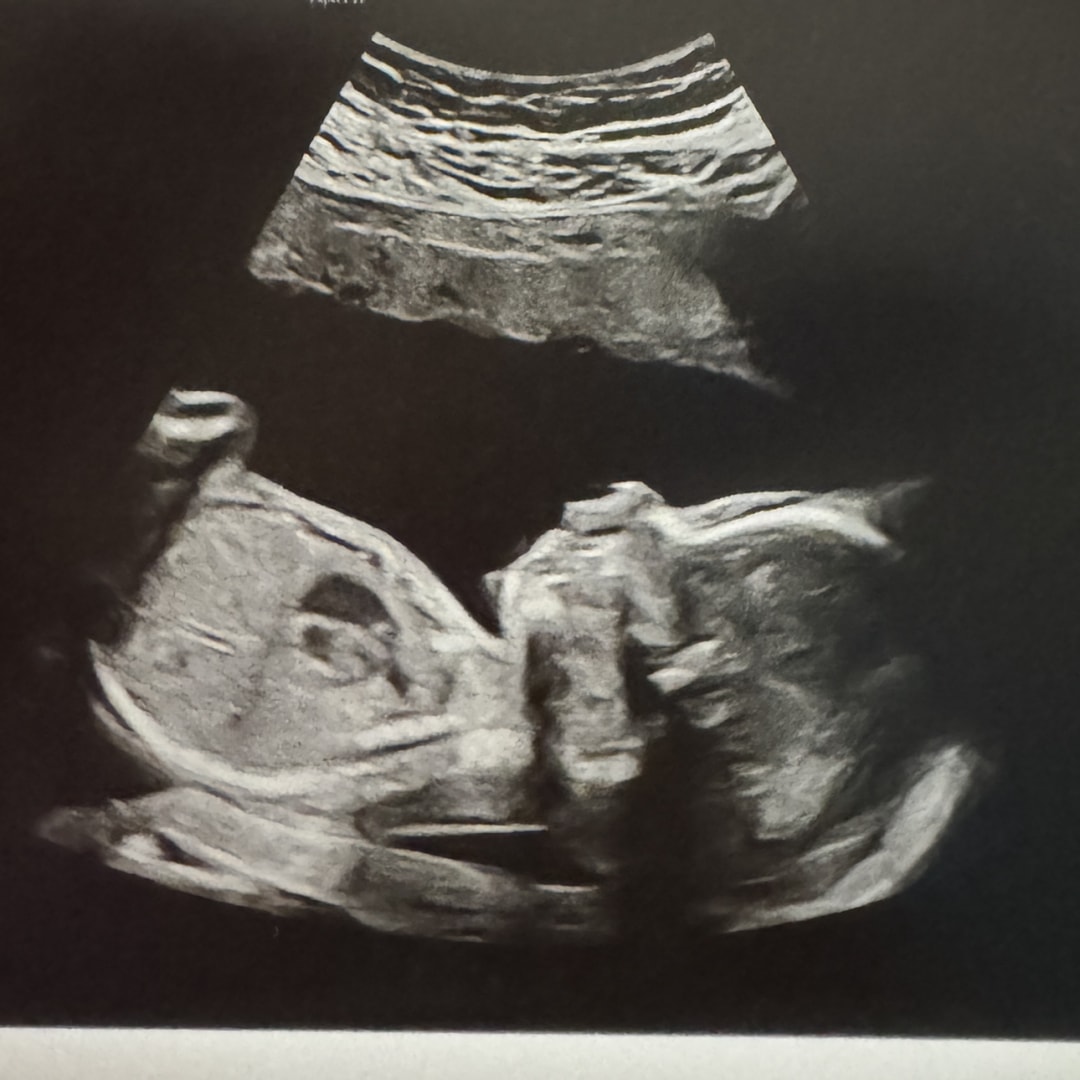 Photo shared by Kendra for their Babylist baby registry.