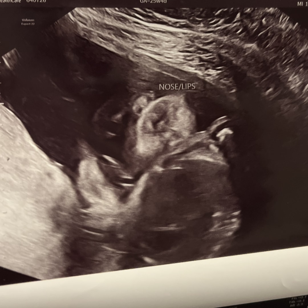 Photo shared by Julianna for their Babylist baby registry.