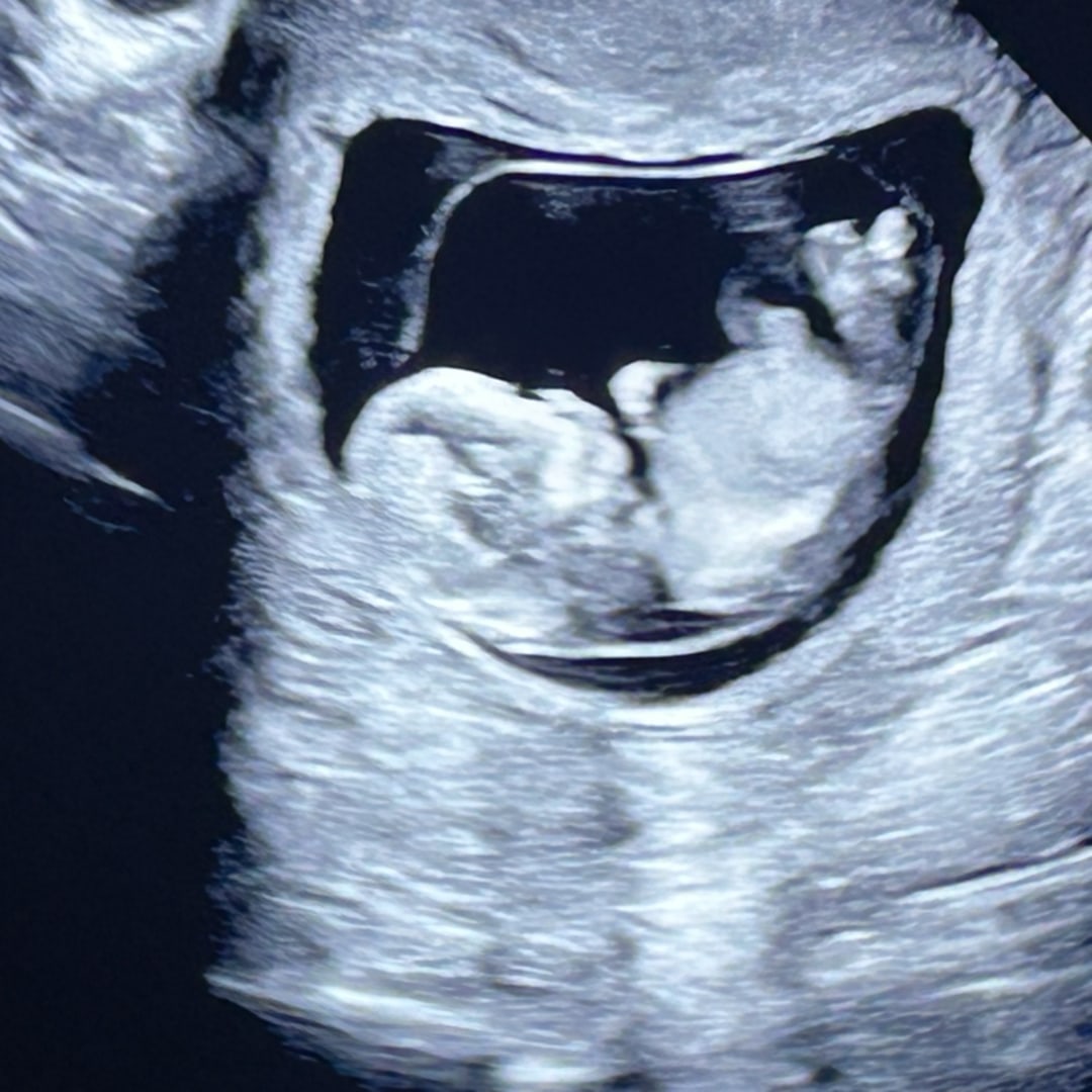 Photo shared by Emry for their Babylist baby registry.