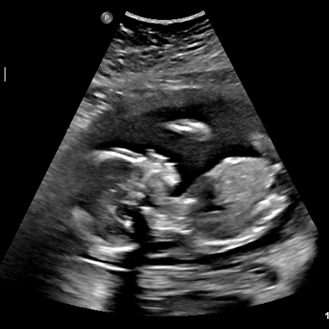 Photo shared by Carolyn for their Babylist baby registry.