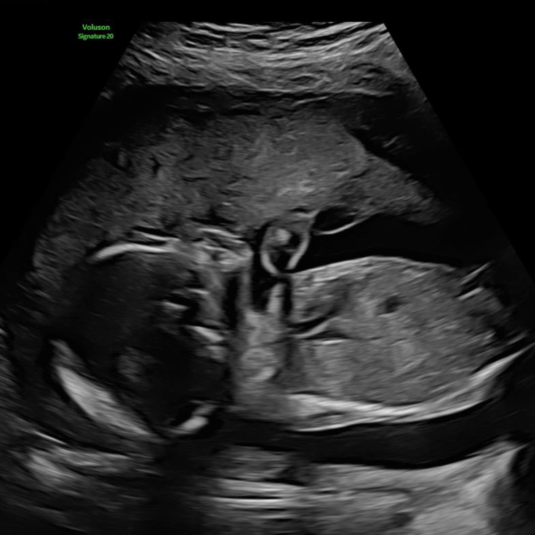 Photo shared by Ninoshca for their Babylist baby registry.