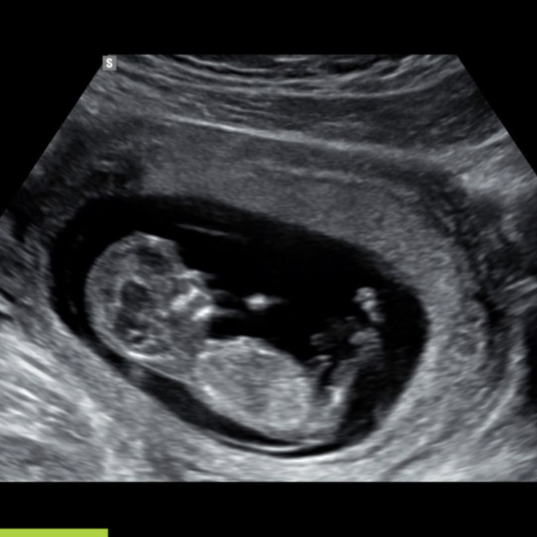 Photo shared by Eden for their Babylist baby registry.