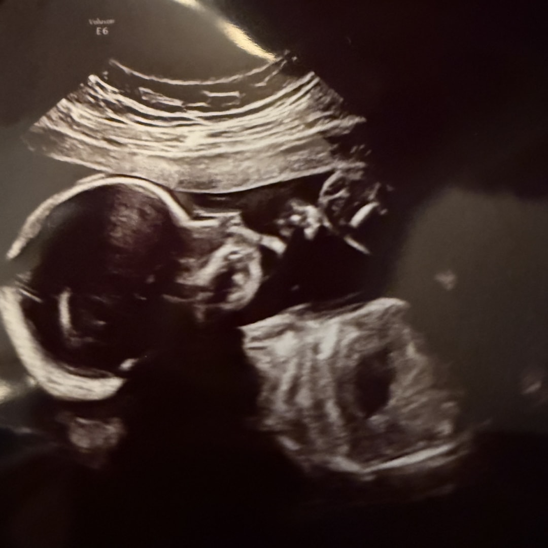 Photo shared by Crissy for their Babylist baby registry.