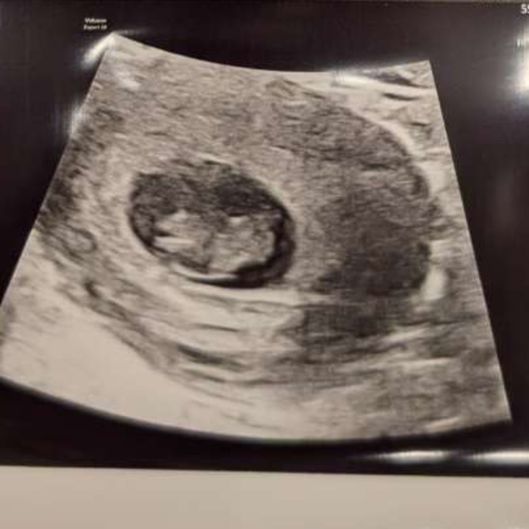 Photo shared by Cierrah for their Babylist baby registry.