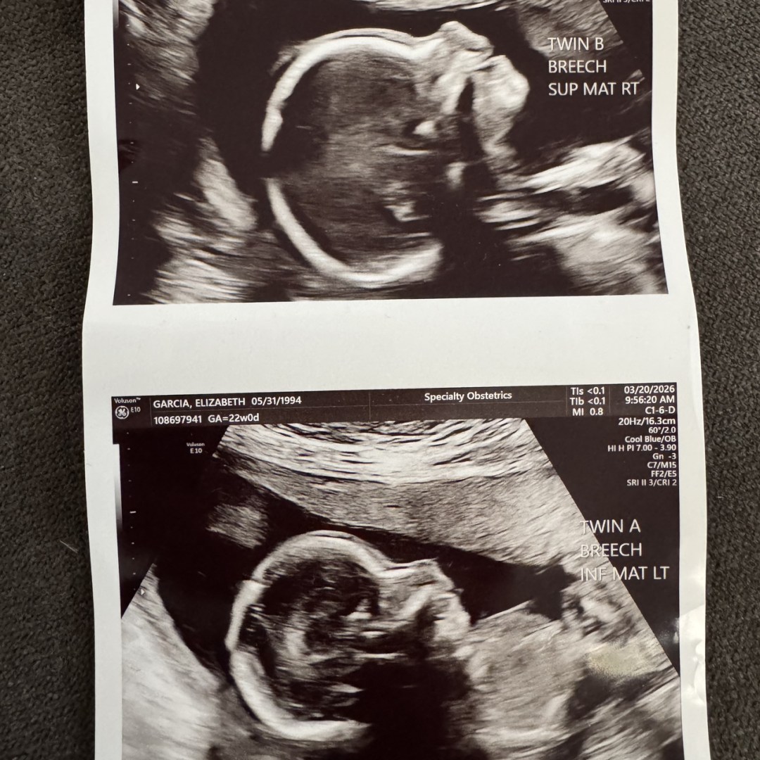 Photo shared by Elizabeth for their Babylist baby registry.