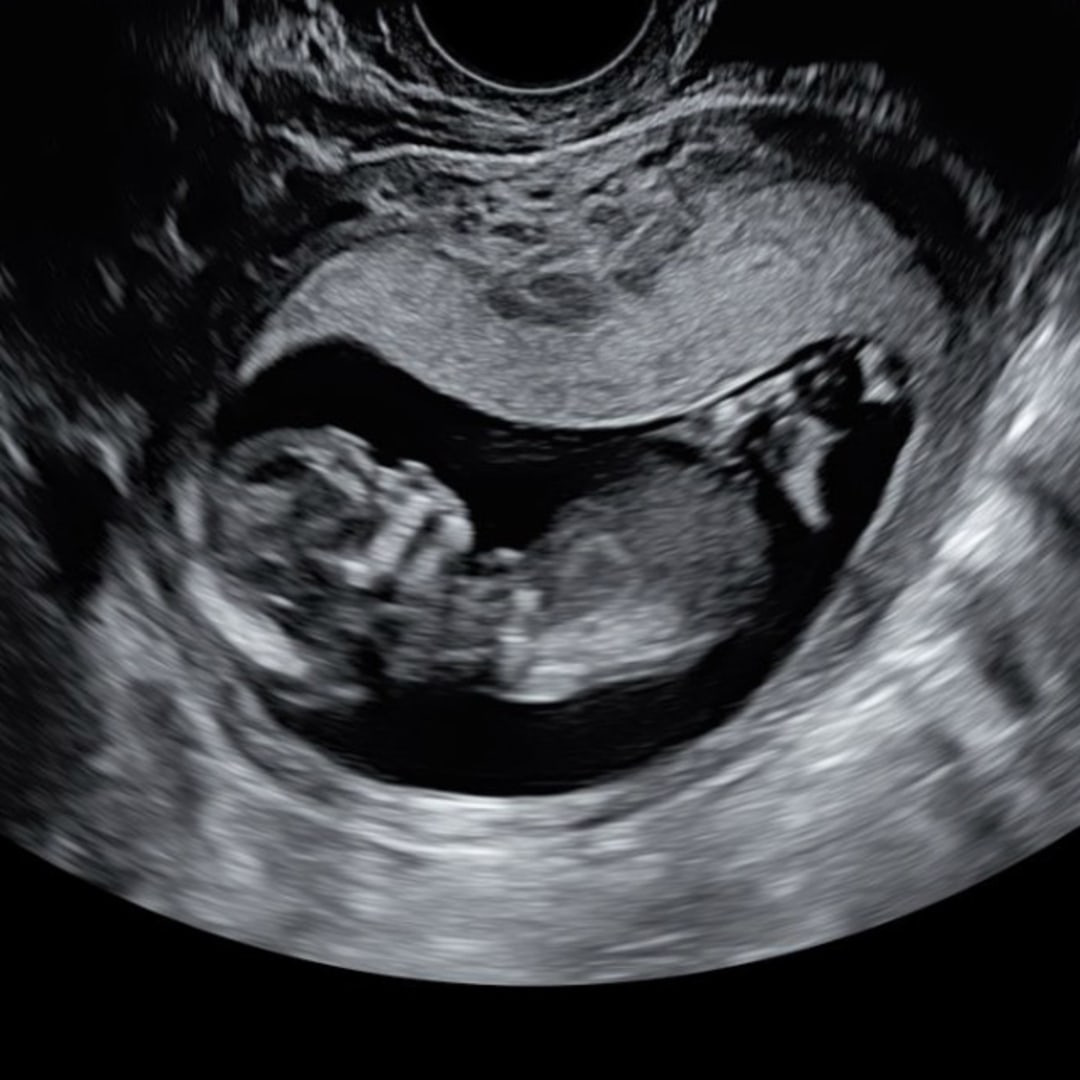 Photo shared by Nathalie for their Babylist baby registry.