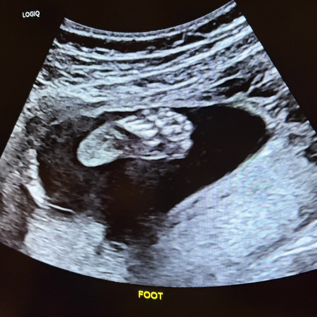 Photo shared by Brittany for their Babylist baby registry.