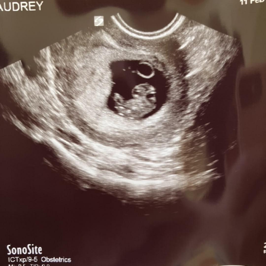 Photo shared by Audrey for their Babylist baby registry.