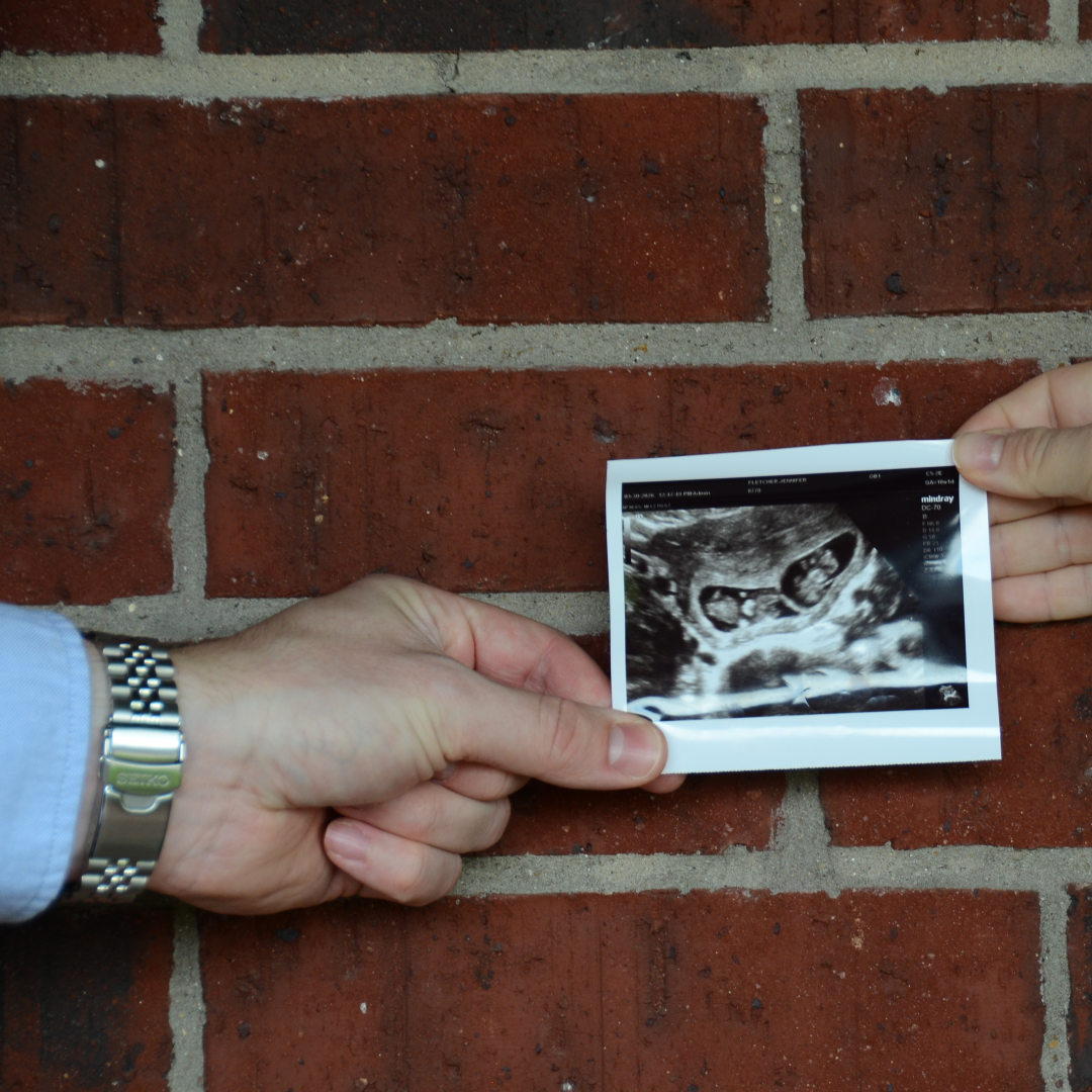 Photo shared by Alex for their Babylist baby registry.