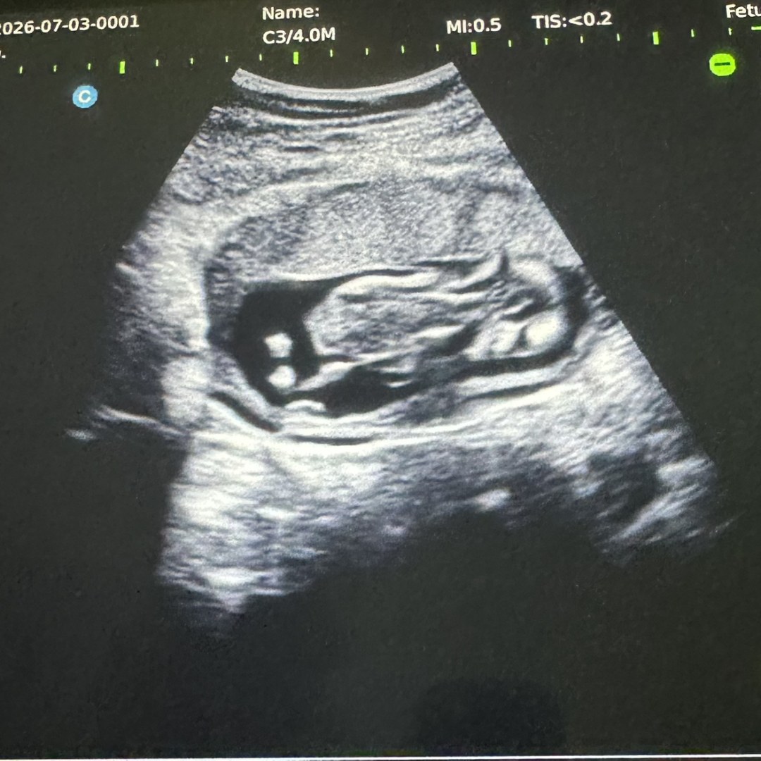 Photo shared by Mariah for their Babylist baby registry.
