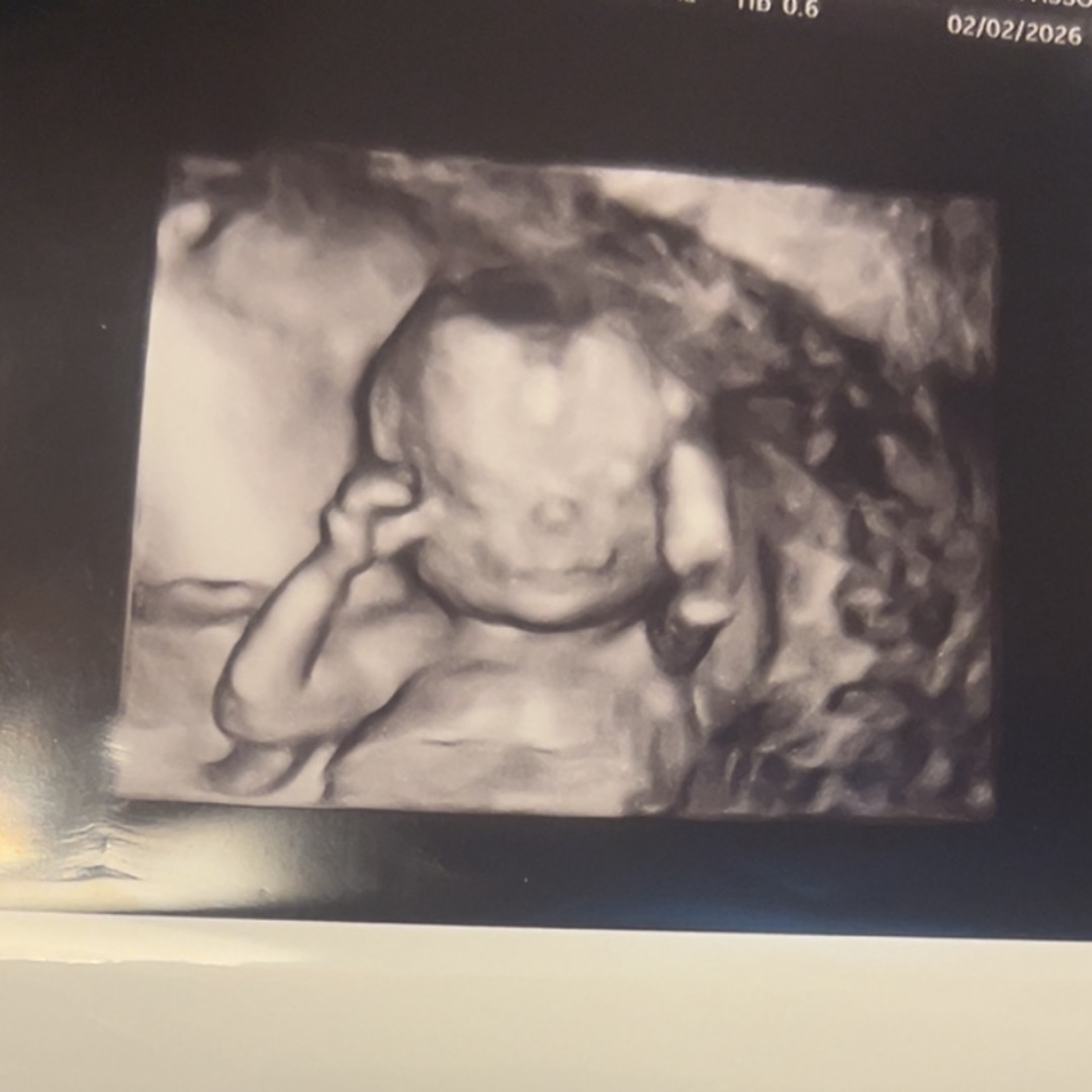Photo shared by Brenda for their Babylist baby registry.