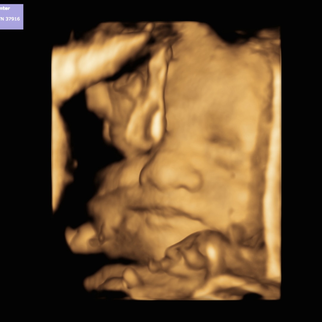 Photo shared by Lacy for their Babylist baby registry.