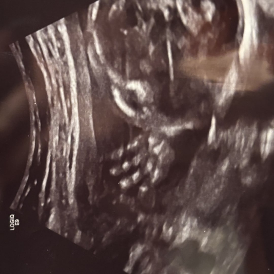 Photo shared by Emma for their Babylist baby registry.