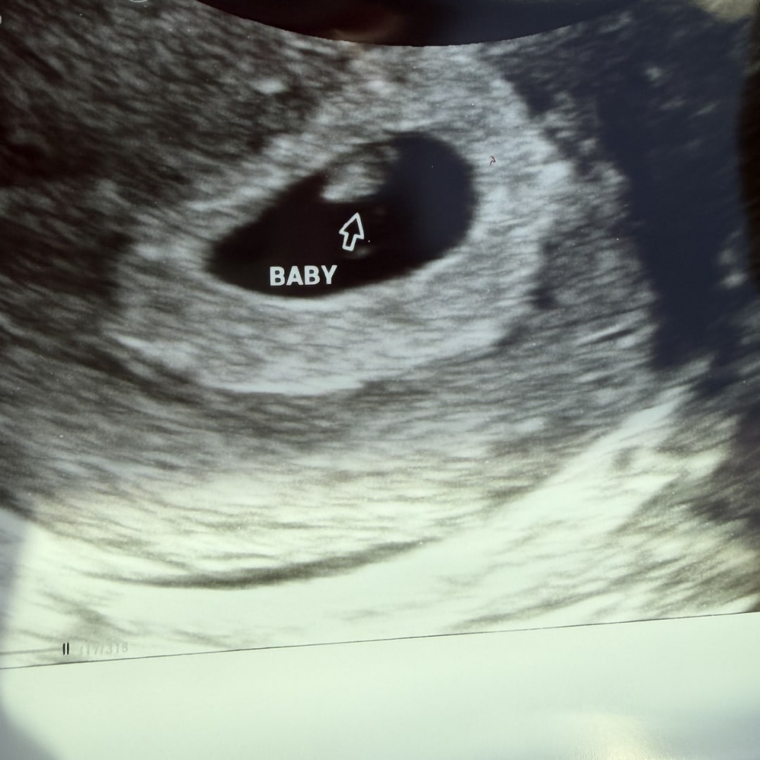 Photo shared by Kayla for their Babylist baby registry.