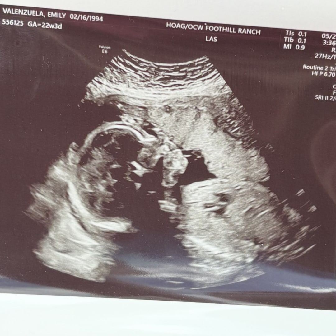 Photo shared by Emily for their Babylist baby registry.
