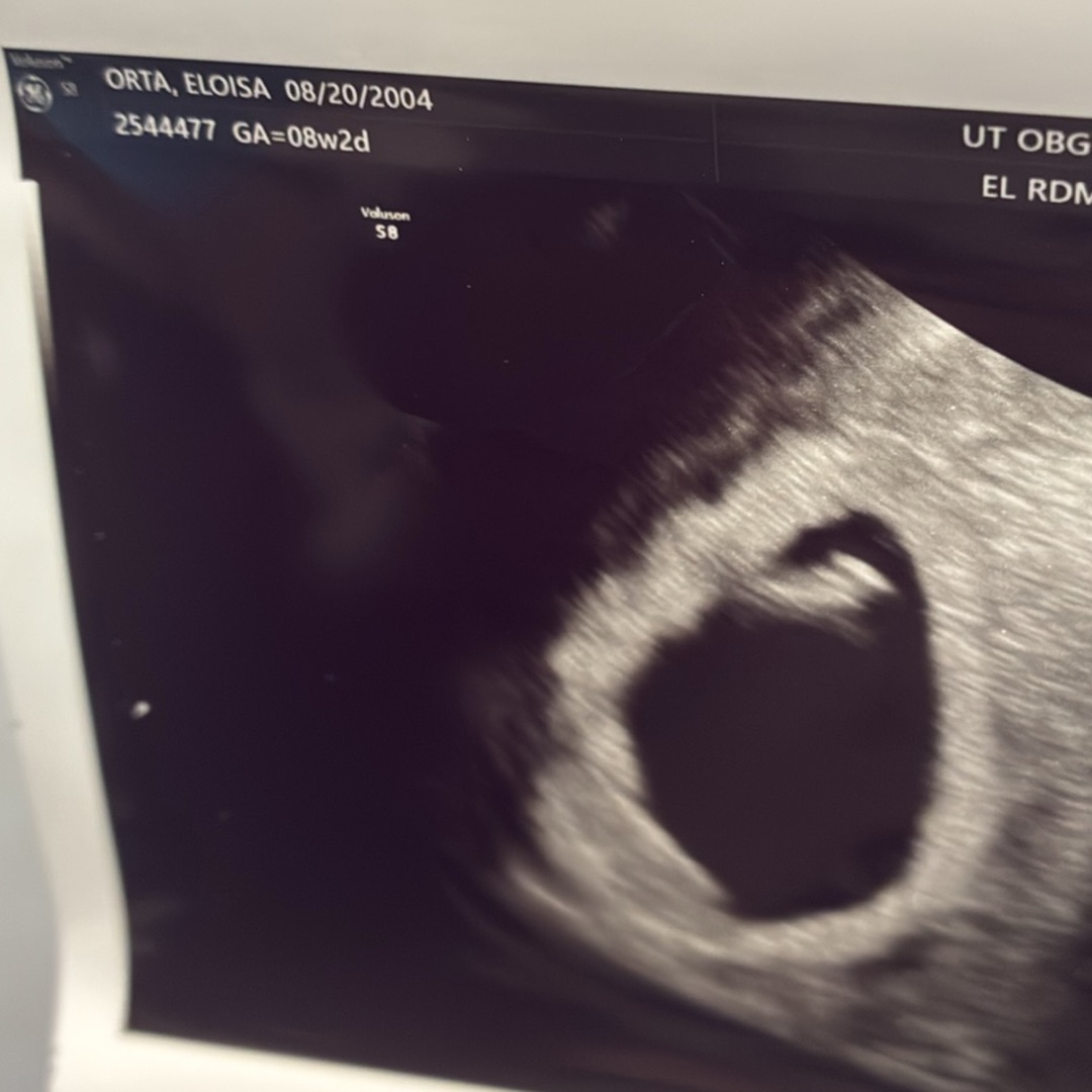 Photo shared by Eloisa for their Babylist baby registry.