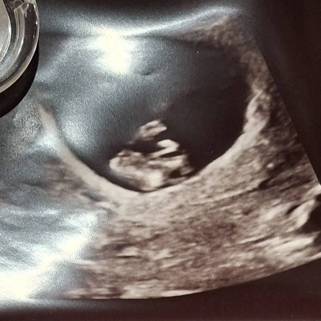 Photo shared by Hailey for their Babylist baby registry.