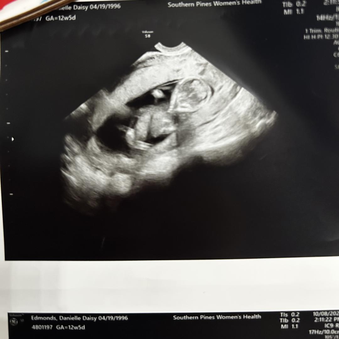 Photo shared by Daisy for their Babylist baby registry.