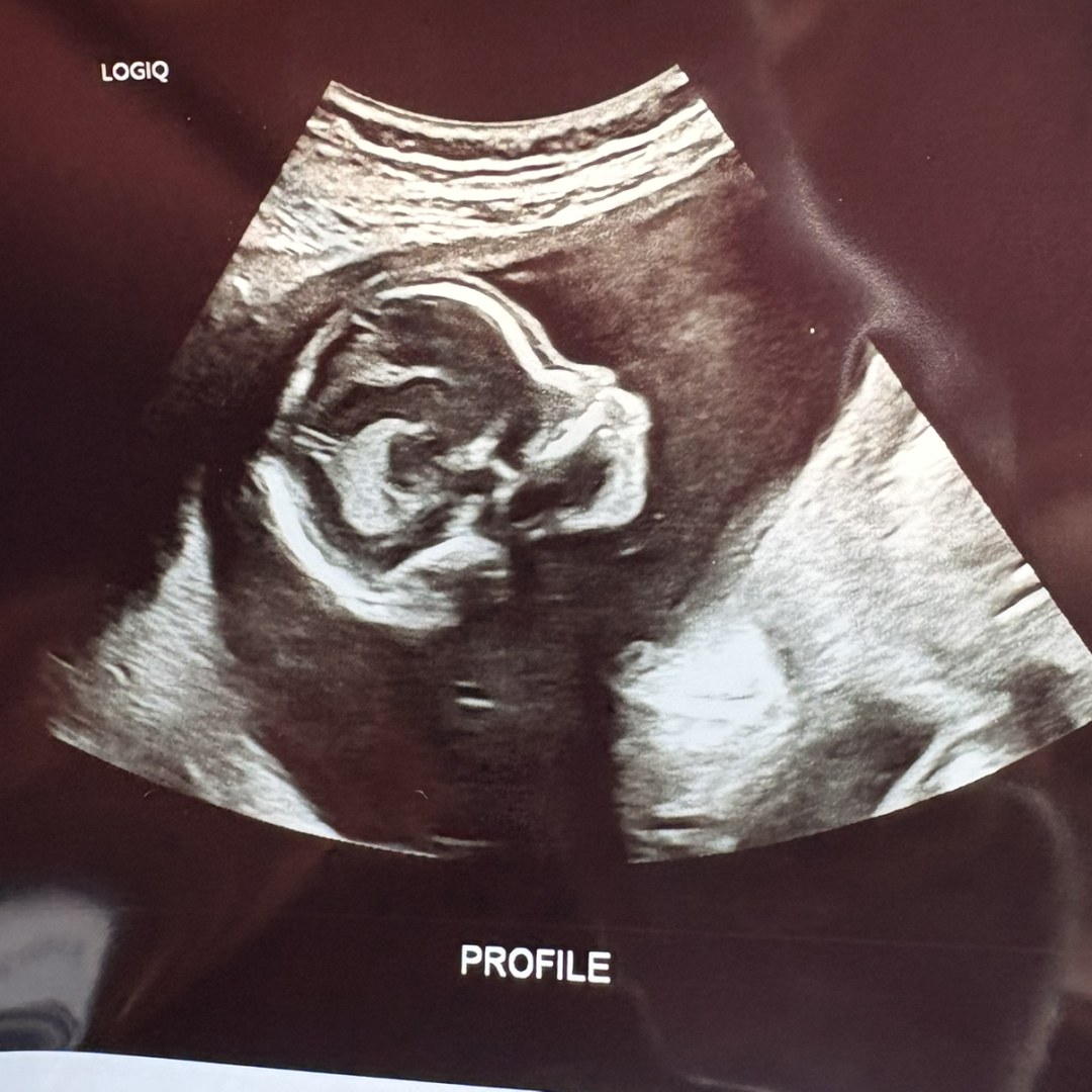 Photo shared by Daniela for their Babylist baby registry.