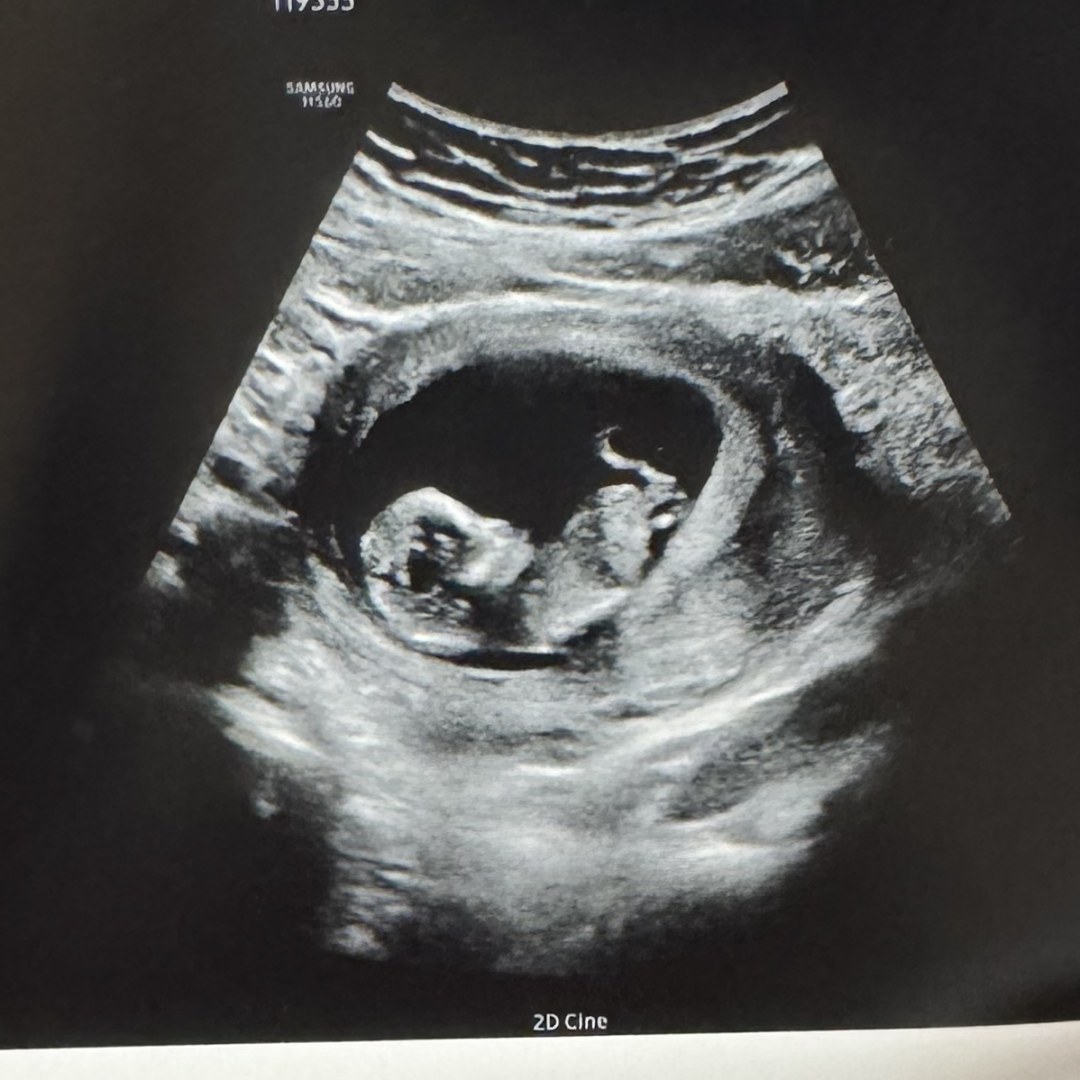 Photo shared by Kaytlan for their Babylist baby registry.