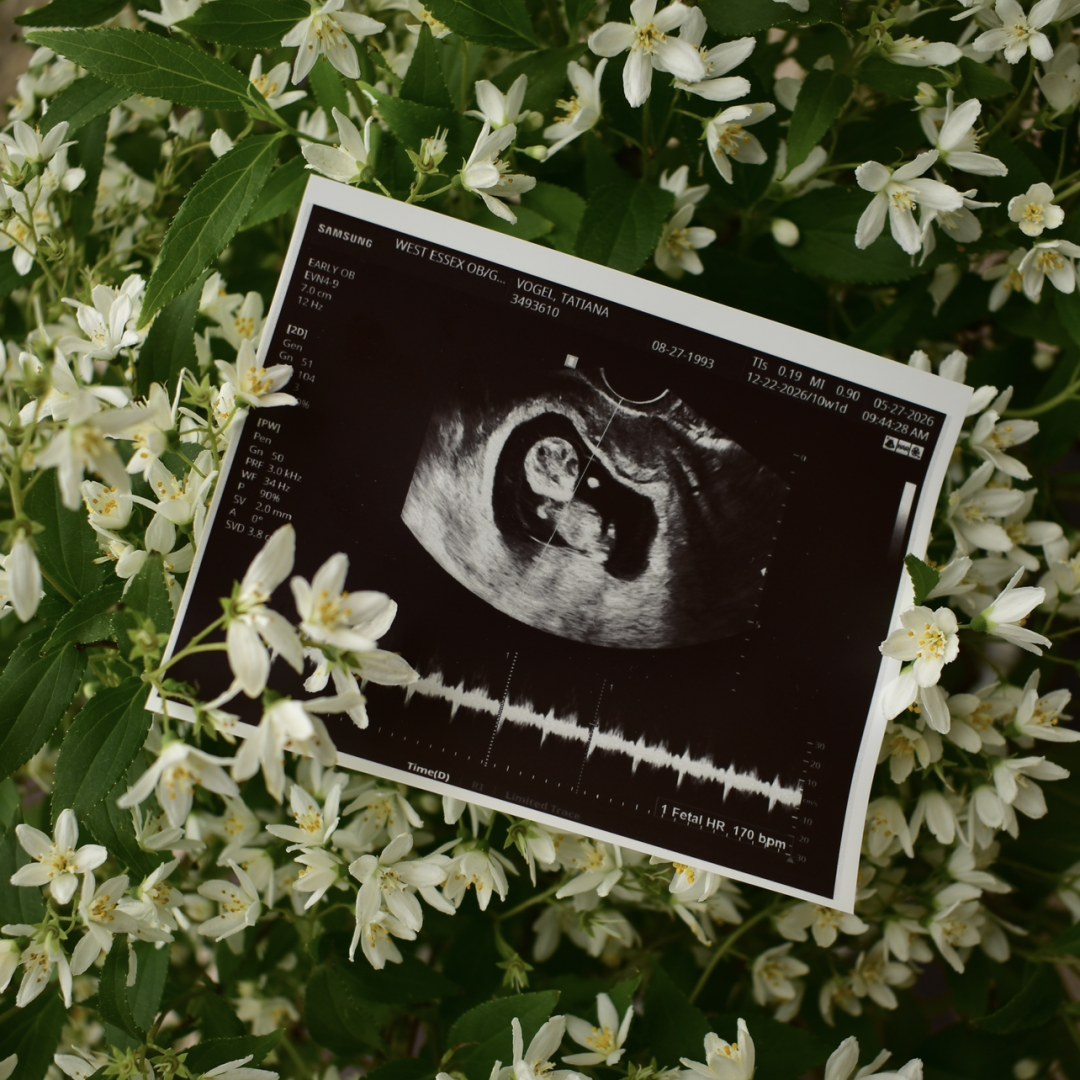 Photo shared by Tatiana for their Babylist baby registry.