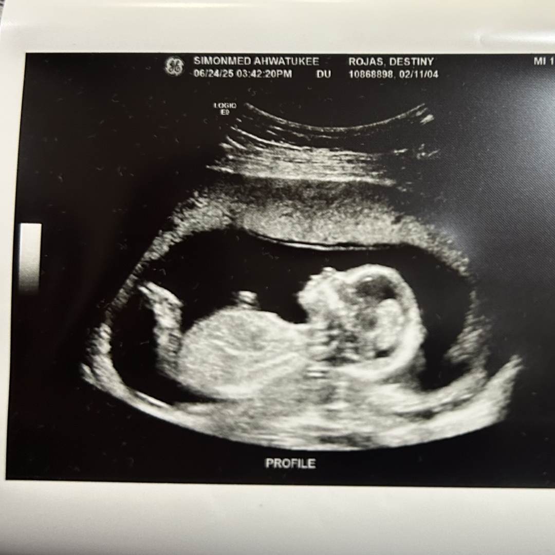 Photo shared by Destiny for their Babylist baby registry.