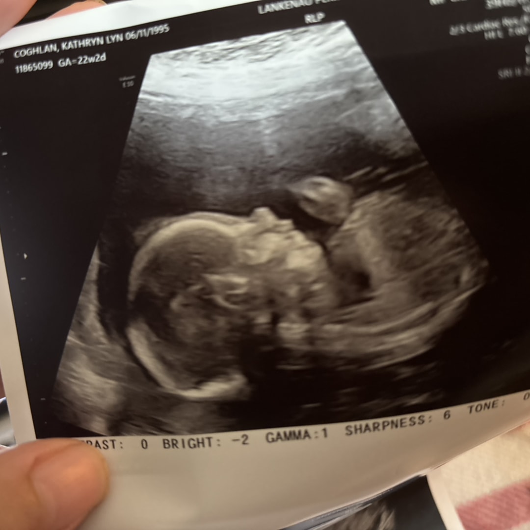Photo shared by Katie for their Babylist baby registry.