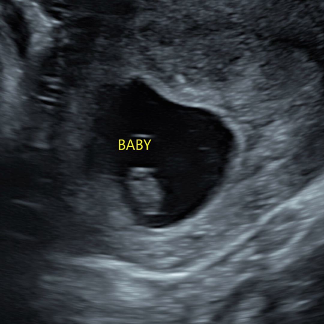 Photo shared by Sophia for their Babylist baby registry.