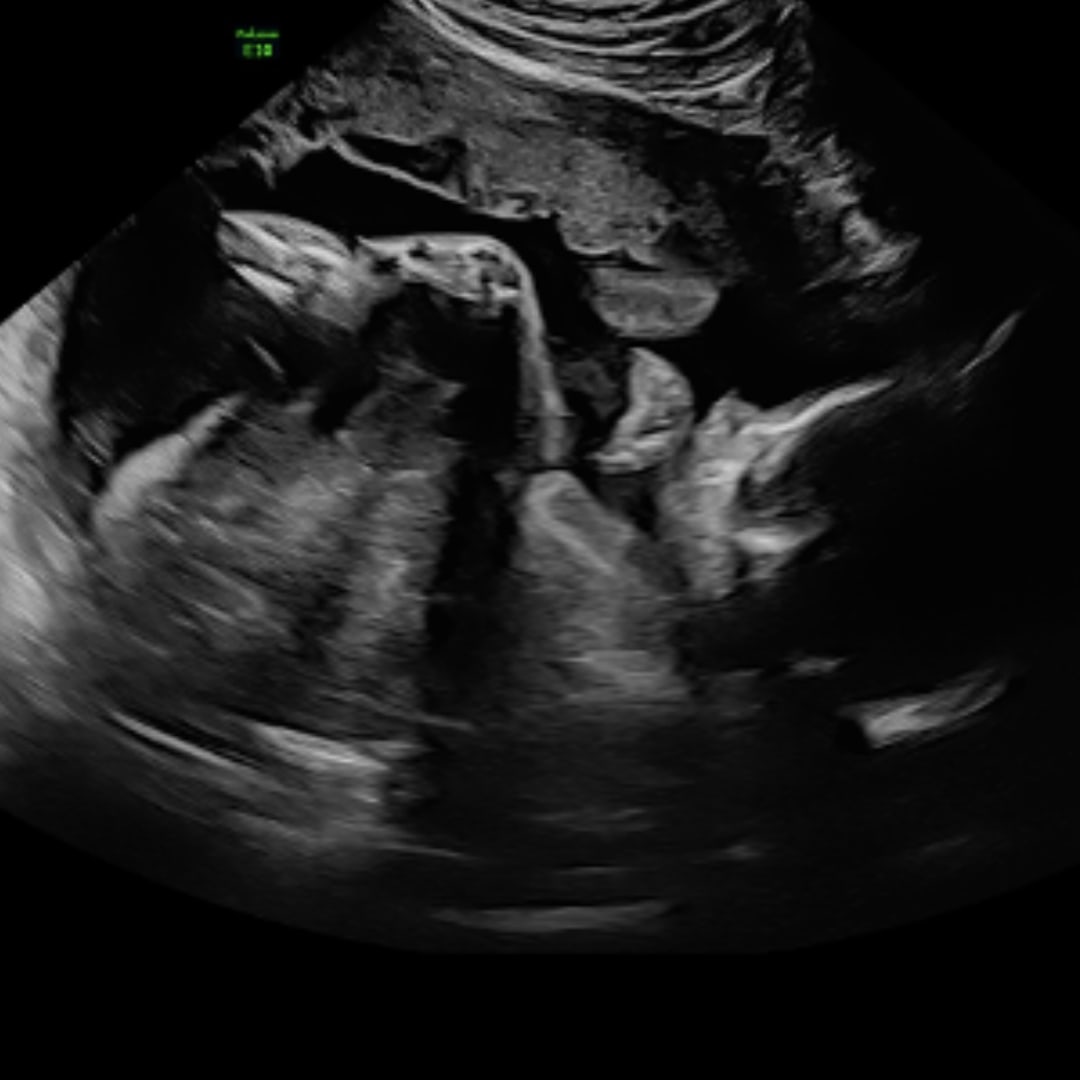 Photo shared by Courtlyn for their Babylist baby registry.