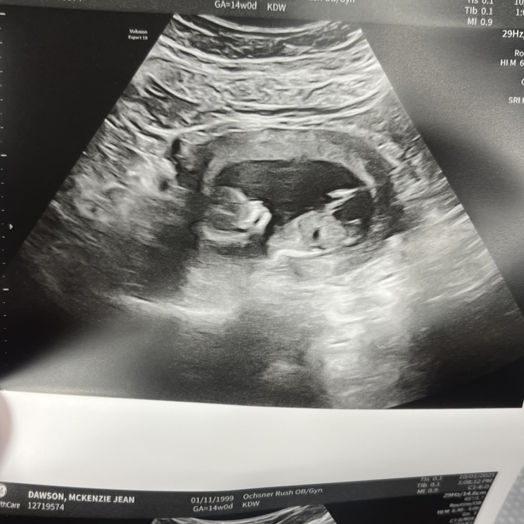 Photo shared by Mckenzie for their Babylist baby registry.