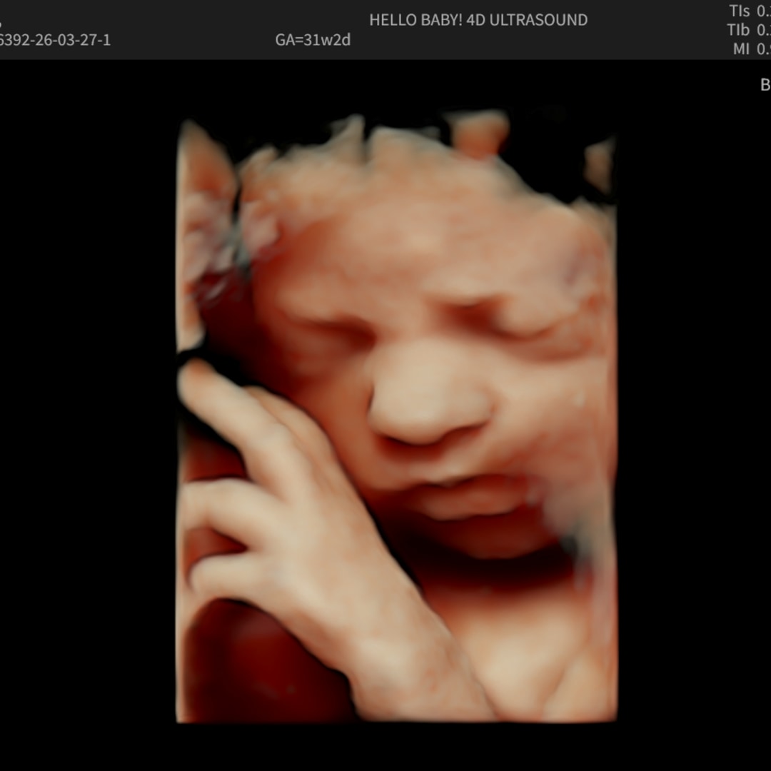 Photo shared by Carly for their Babylist baby registry.