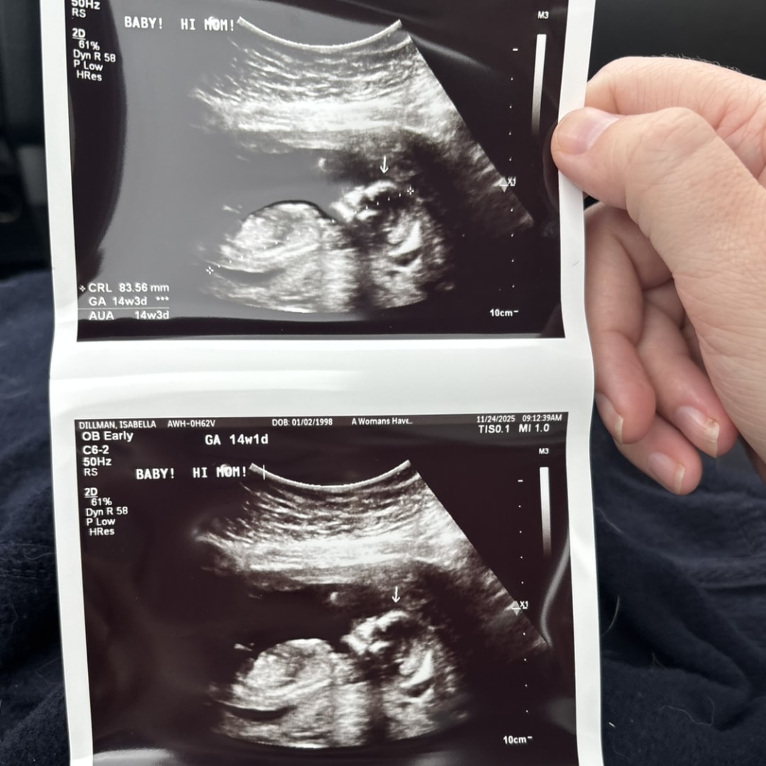 Photo shared by Bella for their Babylist baby registry.