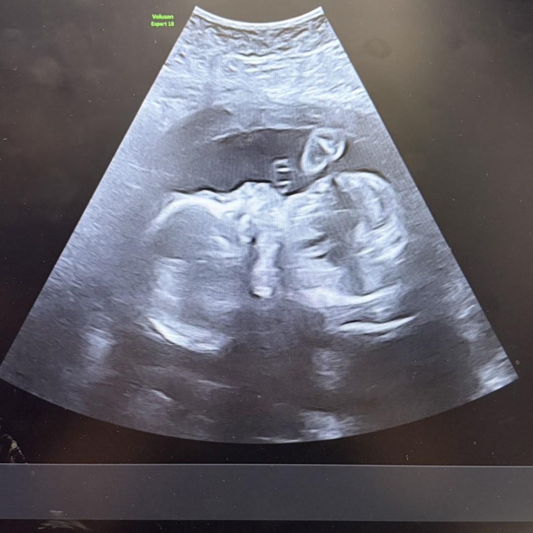 Photo shared by Amanda for their Babylist baby registry.
