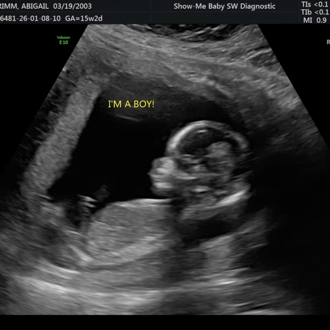 Photo shared by Abby for their Babylist baby registry.