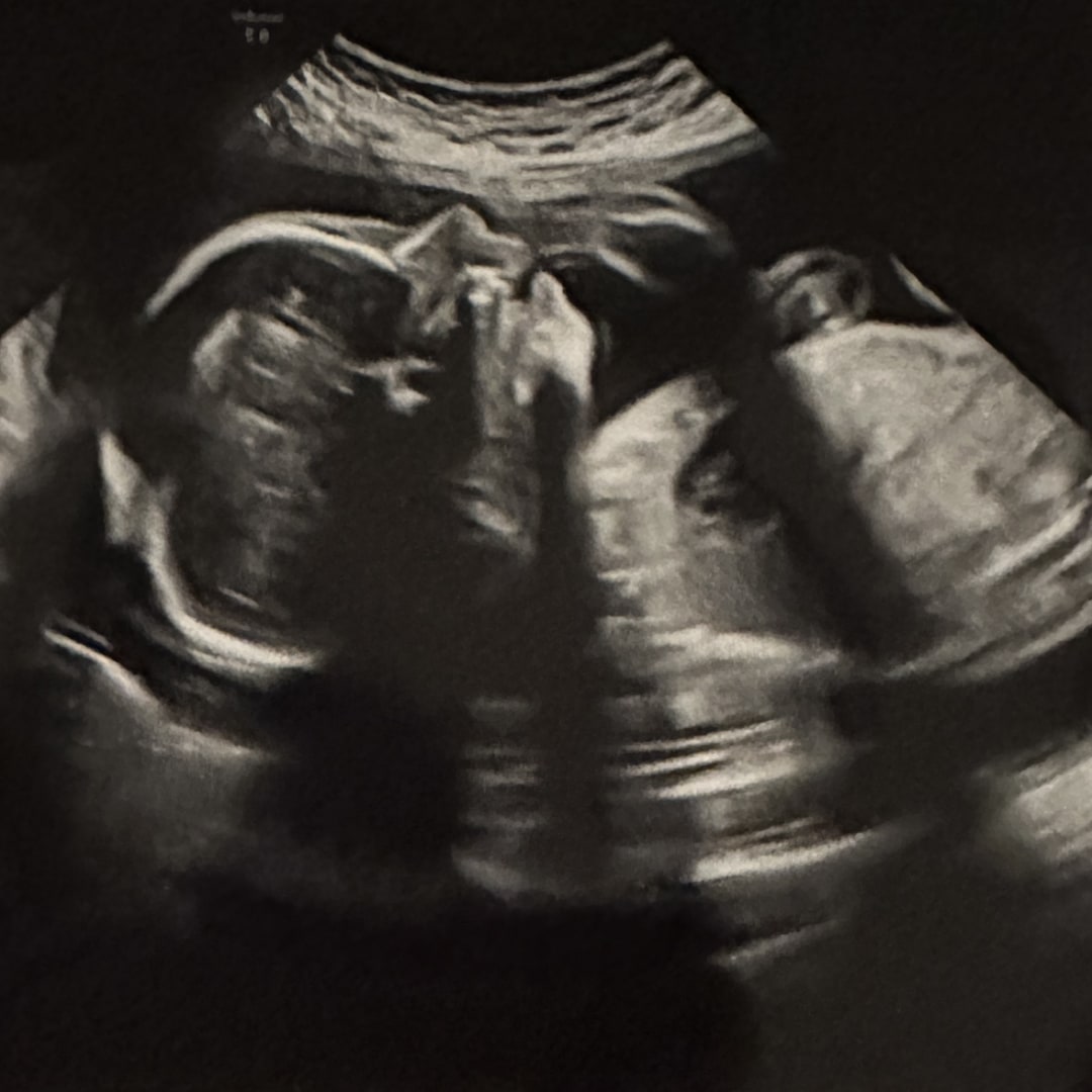 Photo shared by Ellen for their Babylist baby registry.