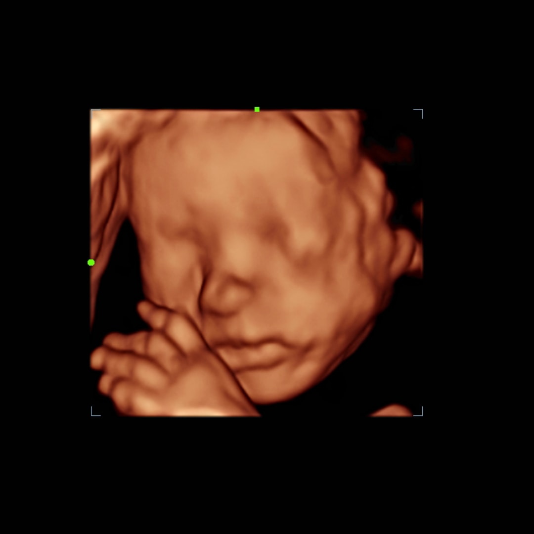 Photo shared by Meghan for their Babylist baby registry.